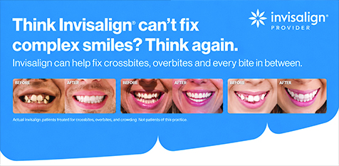 invisalign profile